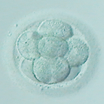 体外受精・胚移植（IVF-ET）